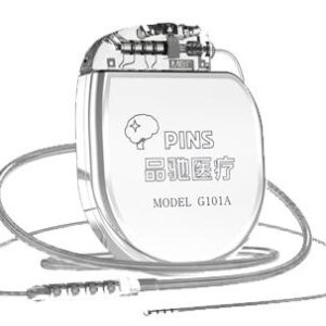 Deep Brain Stimulation (DBS) System - Image 2