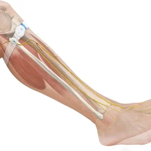 Geko Hospital Application Device - Image 3